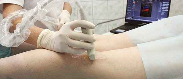 Триплексное ультразвуковое сканирование сосудов ног