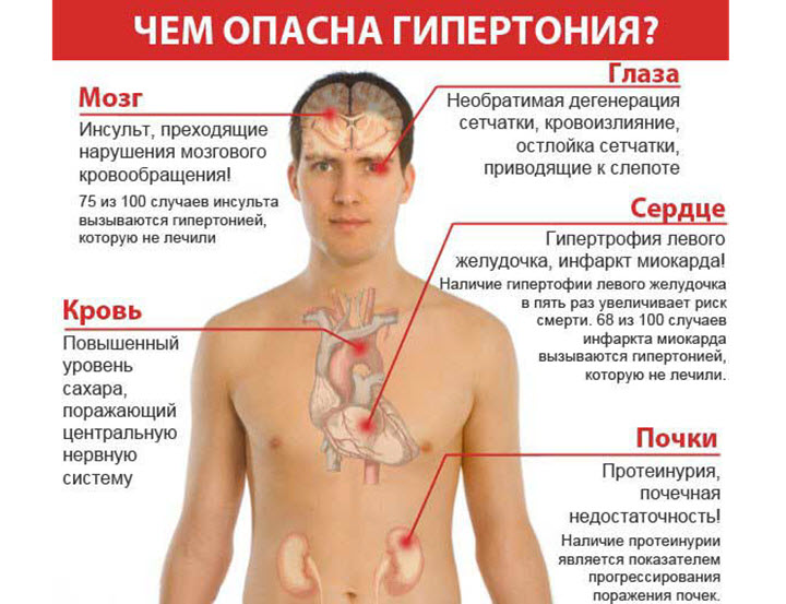 Изображение - Артериальная гипертония риски Stepeni-i-gruppy-riska-gipertonicheskoj-bolezni_1