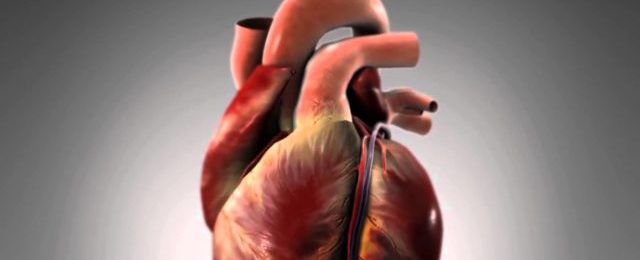 Признаки и лечение типичной формы инфаркта миокарда